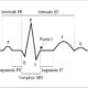Segmentos e intervalos en el electrocardiograma