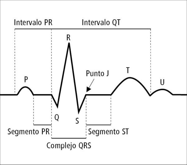 Segmentos e intervalos en el electrocardiograma