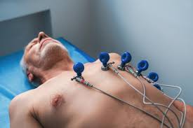El electrocardiograma se obtiene mediante electrodos