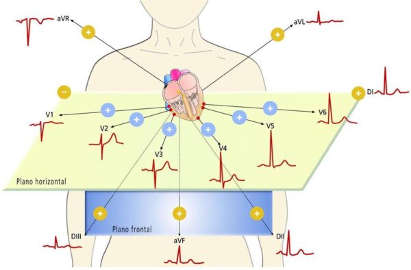 ¿Qué es una derivación del electrocardiograma?