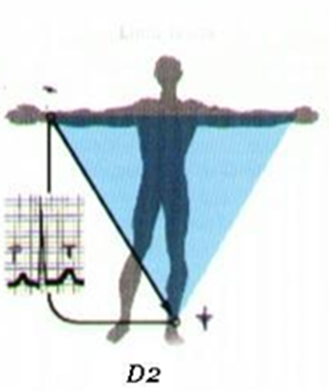 Registro de la despolarización en la derivación DII