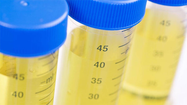 Pruebas de toxicología en pacientes que usan opioides