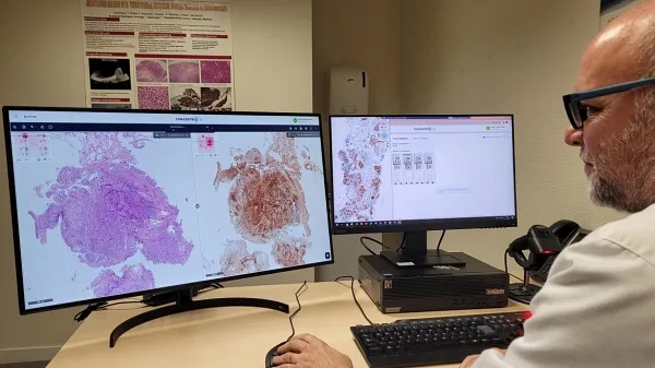 La patología cubre todos los aspectos de la enfermedad