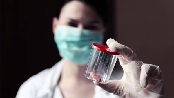 Impacto del análisis de biopsias en la medicina