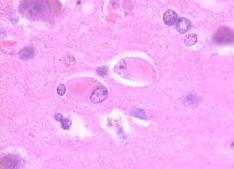 Las proteínas del estrés son citoprotectoras