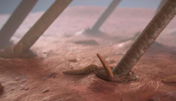 ¿Qué es la foliculitis por Demodex?