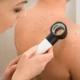 Diagnóstico diferencial de la foliculitis