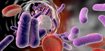 La sepsis y el shock séptico son afecciones potencialmente mortales