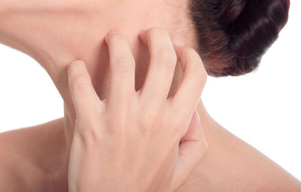 ¿Qué es el prurito?