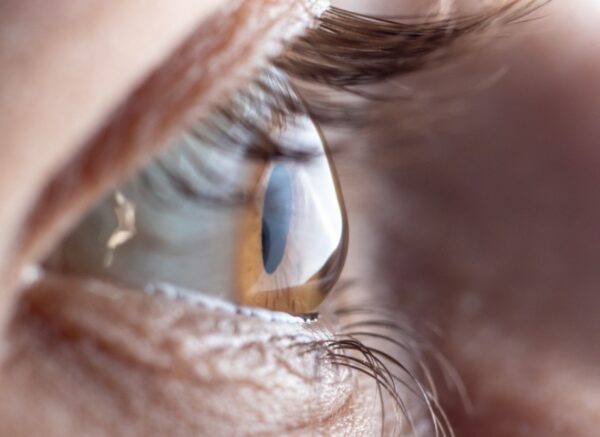 Abrasiones corneales