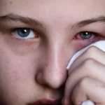Conjuntivitis viral
