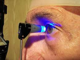 Consecuencias del glaucoma crónico no tratado