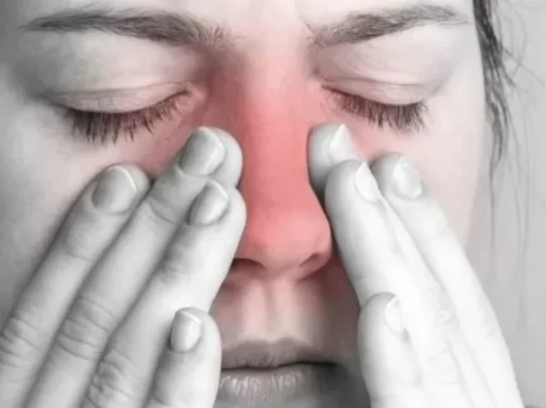 Clasificación de la rinosinusitis