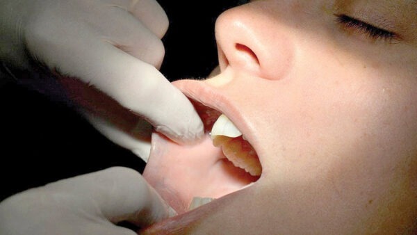 La eritroplasia y la leucoplasia deben investigarse