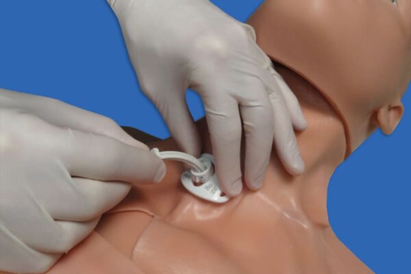 Cricotirotomía y traqueostomía