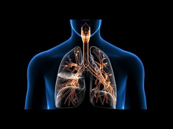 Obstrucción de las vías aéreas inferiores