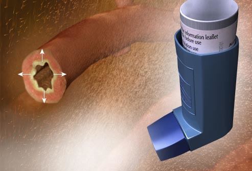 Agonistas beta-adrenérgicos en el tratamiento del asma