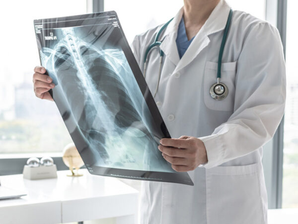 Causas de la Enfermedad Pulmonar Obstructiva Crónica