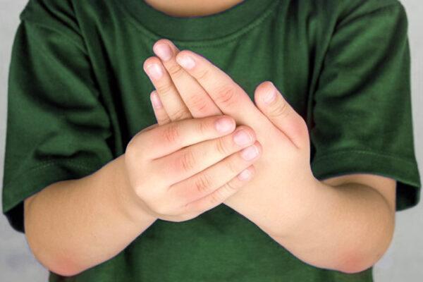 La artritis idiopática juvenil se parece a la artritis reumatoide