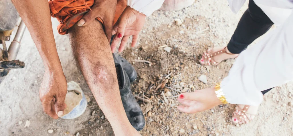 ¿Qué transmite la leishmaniasis?