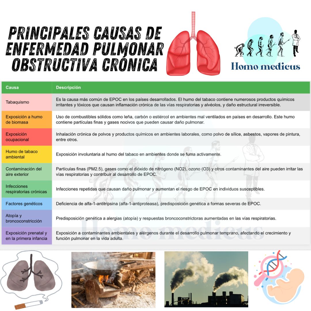 Causas de la Enfermedad Pulmonar Obstructiva Crónica