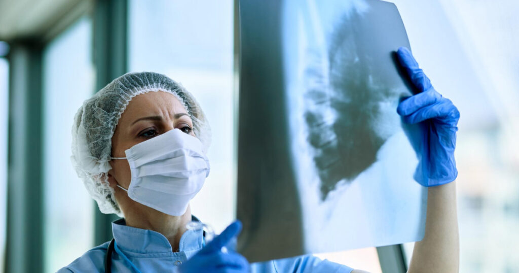 Pruebas diagnósticas para neumonía adquirida en la comunidad