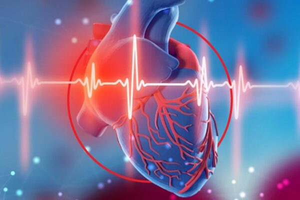 Defectos mecánicos como complicación de infarto