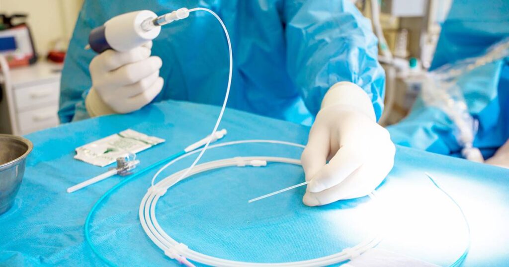 Indicaciones para la cateterización y la intervención coronaria percutánea