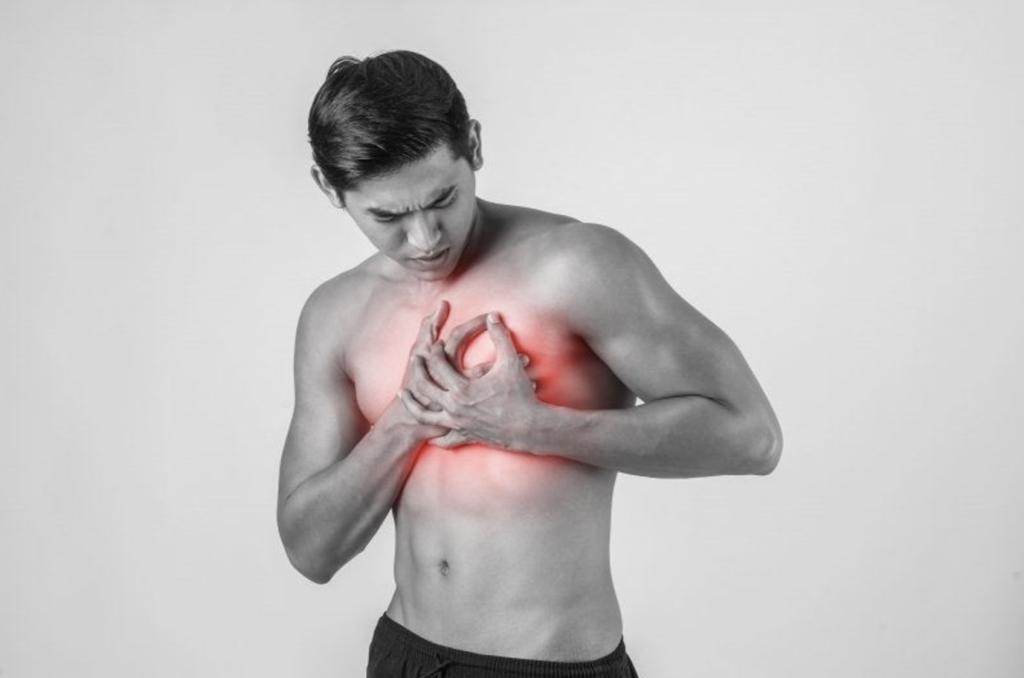 Pericarditis inflamatoria aguda