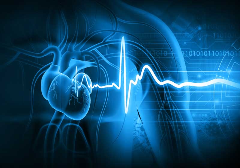 Infarto del ventrículo derecho