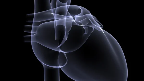 Pericarditis en pacientes con infarto