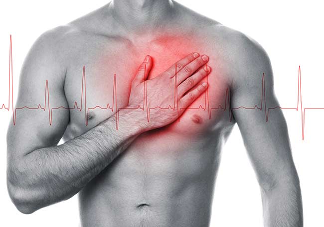 Vasoespasmo coronario y angina o infarto de miocardio con arteriogramas coronarios normales