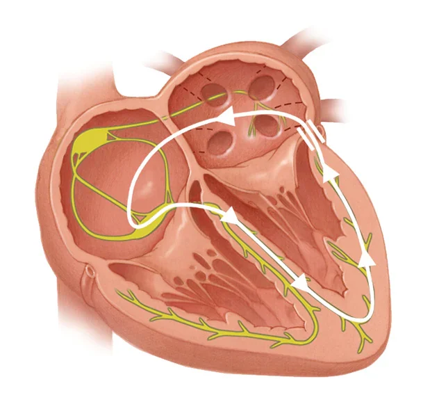 Síndromes de Preexcitación