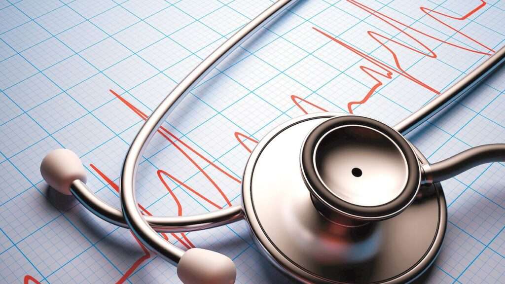 Control de frecuencia y ritmo en pacientes con fibrilación atrial