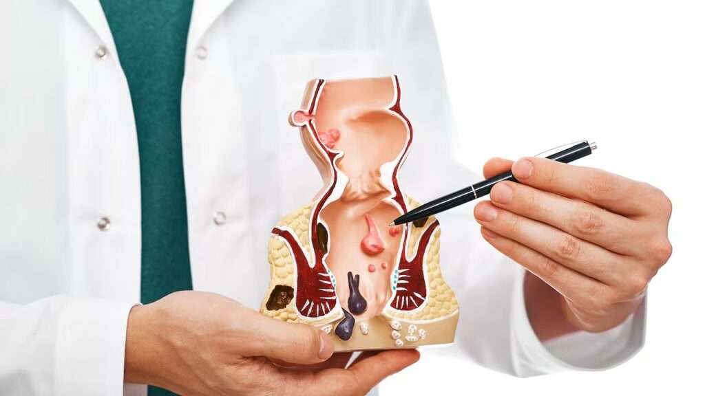 Tratamiento de la enfermedad hemorroidal