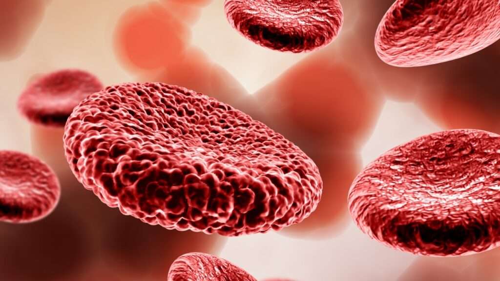 Anemia asociada a enfermedades crónicas