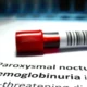 Hemoglobinuria paroxística nocturna