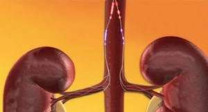 Procedimientos que modulan la actividad del sistema nervioso autónomo