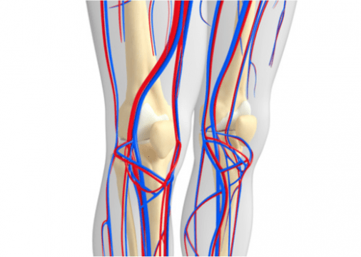 Enfermedad oclusiva de las arterias femoral y poplítea