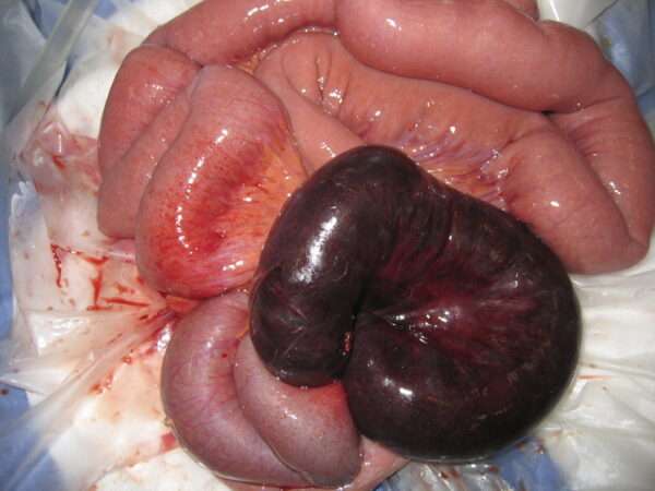 Isquemia mesentérica (Angina intestinal)