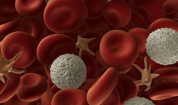 Anemia hemolítica autoinmune