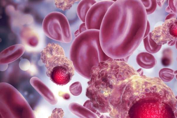 trastornos mieloproliferativos