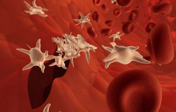 Causas de trombocitopenia