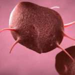 Trastornos congénitos de la función plaquetaria