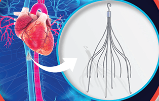Terapia no farmacológica para la enfermedad tromboembólica venosa