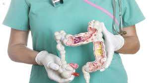 Causas de sangrado del tubo digestivo bajo