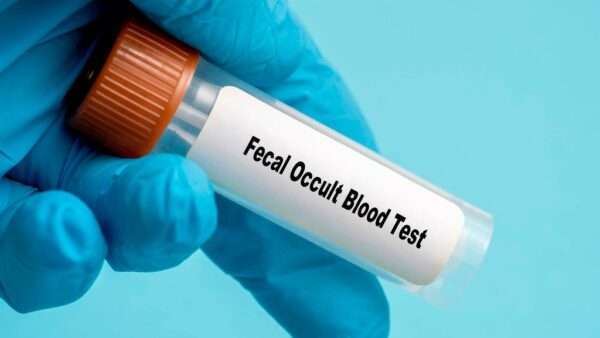 Sangrado oculto del tubo digestivo