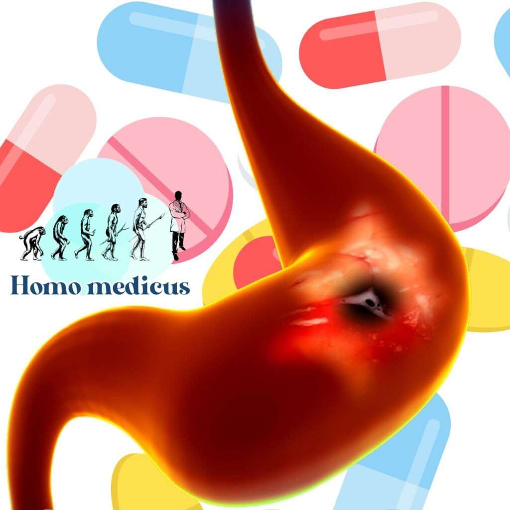 Agentes que mejoran la curación de las úlceras pépticas