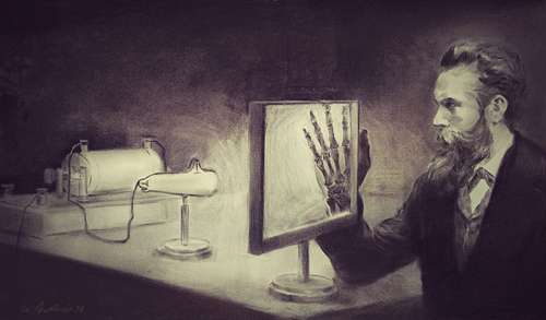 Papel de los rayos X en el desarrollo de la cirugía