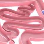 Gas gastrointestinal